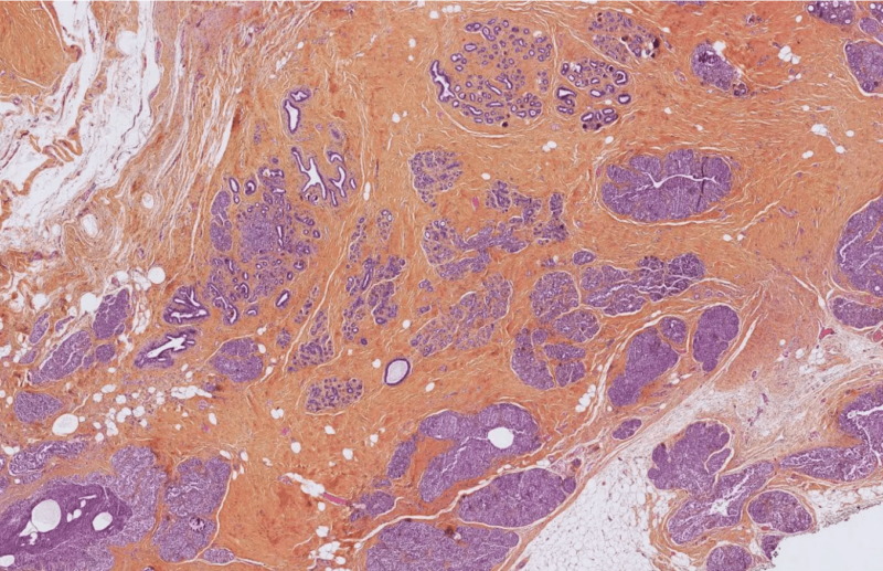 Primaa - An automated TILs scoring Tool.