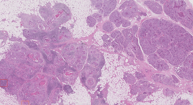 Primaa - End-to-End Pipeline for automatic IHC grading in Breast Cancer
