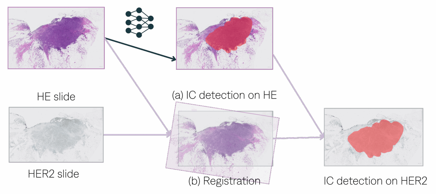 HER2 - Second Diagram