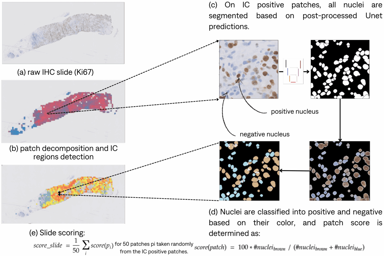 Inference pipeline plan with visual histological slides