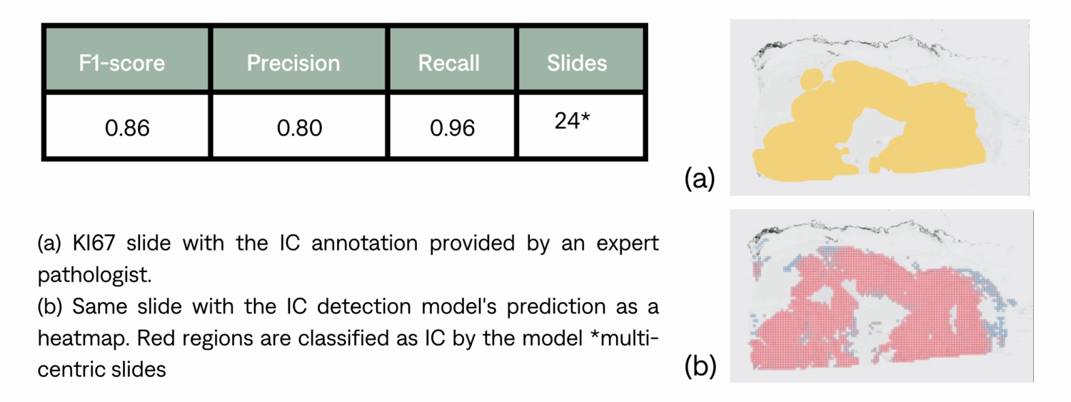 IC detection plan 