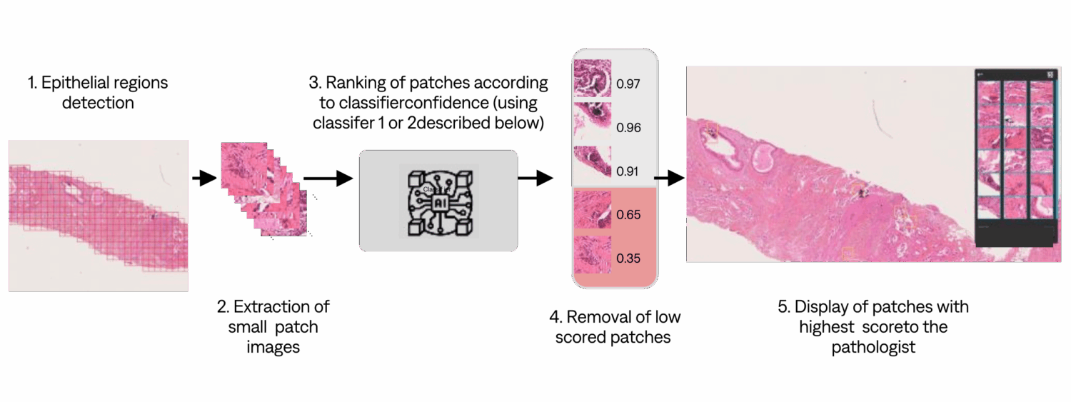 Microcalcification détection plan with visuals 
