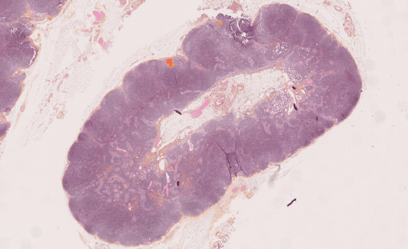 Primaa - Cleo Breast, the AI-powered breast cancer diagnostic tool developed by Primaa, obtains CE-IVDR marking for micrometastasis detection.